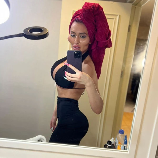 Cô gái nhận kỷ lục có gò má cao nhất thế giới, vẫn quyết tâm bơm cao thêm khiến bác sĩ phải cấm vì quá nguy hiểm-1