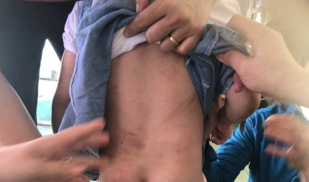 Vụ cháu bé 4 tuổi bị đánh bằng cán chổi, móc áo vì lười ăn: Tạm giữ dì ruột-1