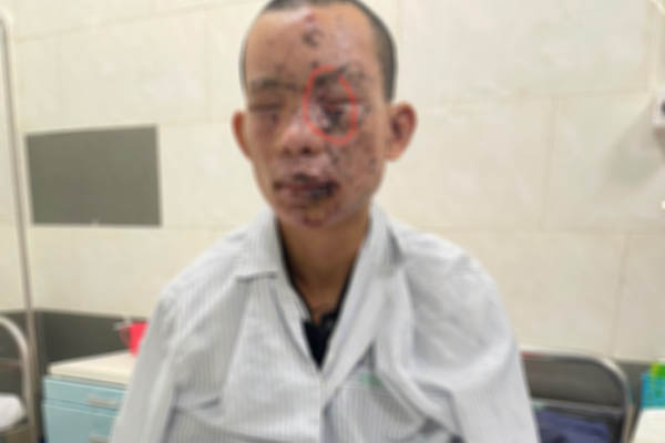 Đi bấm huyệt, bé gái bị người đàn ông mù giao cấu-2