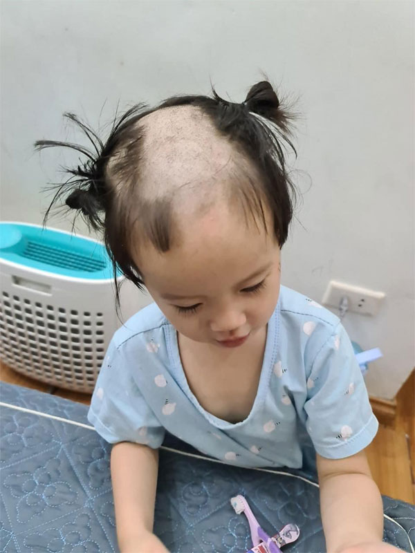 Mẹ chăm mãi tóc con mới dài, bé gái cua 1 lần mất luôn cả bộ tóc, nhìn đến nhân vật bị vạ lây mới hết hồn-1