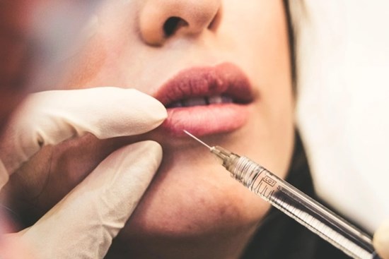Mất thị lực sau tiêm filler làm đầy rãnh má tại tiệm tóc