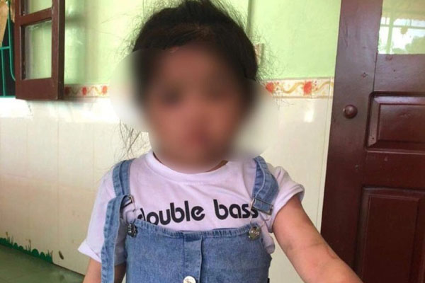 Chân tướng dì ruột dùng cán chổi đánh cháu gái 4 tuổi nhập viện-2