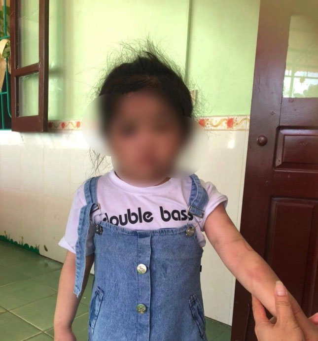 Thông tin mới vụ dì ruột dùng chổi sắt đánh bé gái 4 tuổi vì lười ăn-2