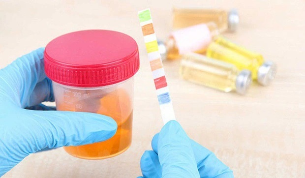 3 thay đổi khi đi tiểu ngầm cảnh báo tế bào ung thư đã xâm nhập vào cơ thể, nếu bạn không có thì xin chúc mừng-1