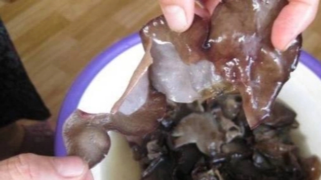 Phụ nữ có 5 đặc điểm này chứng tỏ estrogen trong cơ thể thấp, khi còn trẻ mà không cải thiện ngay sẽ già nhanh không kịp cản-6