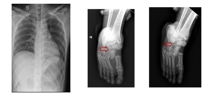 TP.HCM: Thang máy rơi, hai người bị liệt 2 chân-1