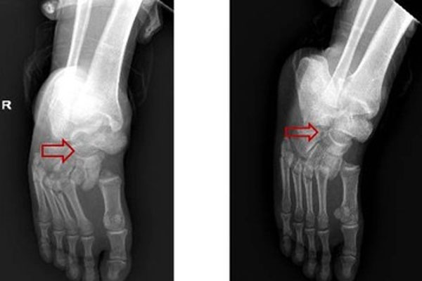 Bé gái bị mắc kẹt khi cầm ô đi thang máy một mình, mẹ hoảng sợ gọi cứu hộ-1