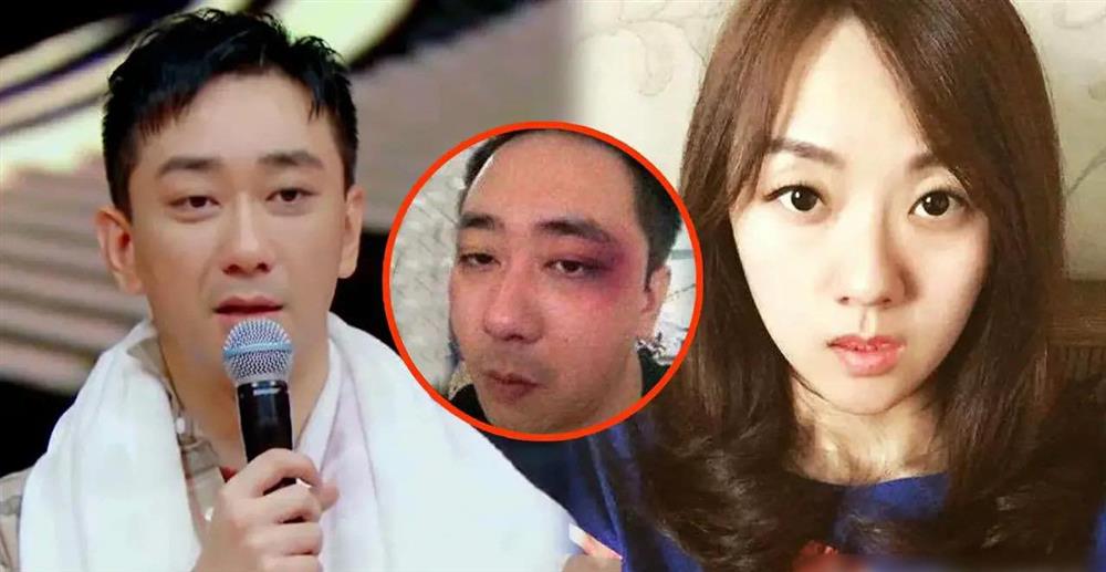 Vụ bạo hành gia đình có 1-0-2 trong showbiz: Sao nam bị vợ tát 500 cái, phải quỳ gối cầu xin để không đánh vào mặt-1