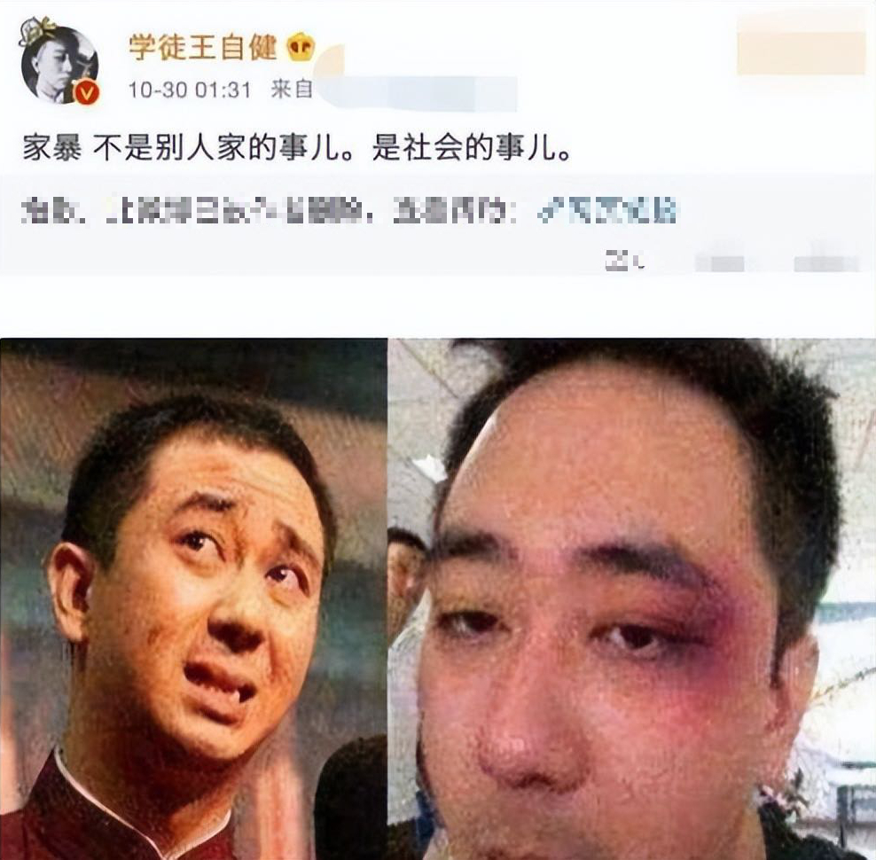 Vụ bạo hành gia đình có 1-0-2 trong showbiz: Sao nam bị vợ tát 500 cái, phải quỳ gối cầu xin để không đánh vào mặt-6