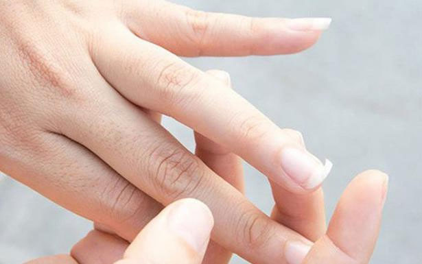 Xuất hiện 8 dấu hiệu này cảnh báo cơ thể bạn đang thiếu canxi trầm trọng, nên kiểm tra ngay để phòng hậu hoạ-1