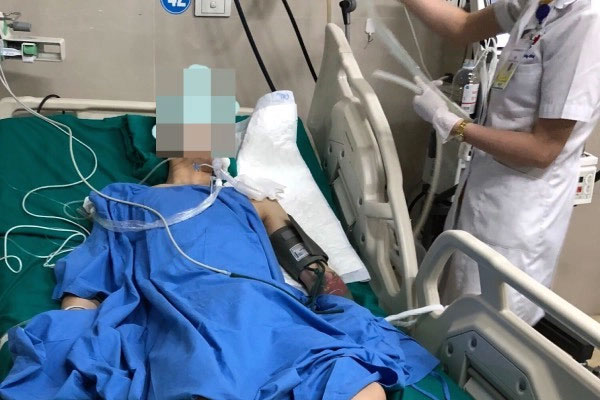 Say thuốc lào, người đàn ông ngã gãy xương đòn vai-3