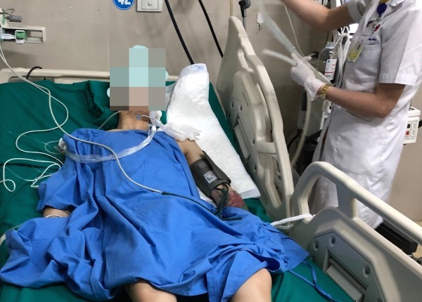 Nam thanh niên 25 tuổi nguy kịch sau khi hút một điếu thuốc lào-1