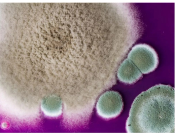 Cảnh báo nấm kháng thuốc có thể lây nhiễm vào phổi người-1