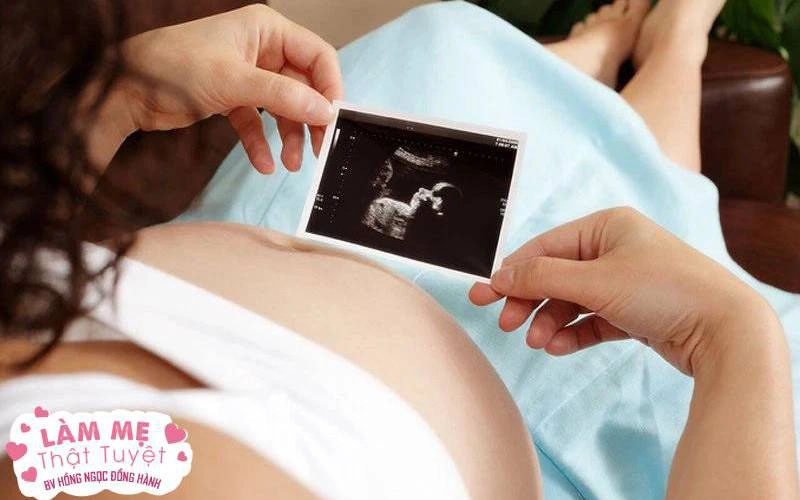 9 nguyên nhân tăng nguy cơ dị tật thai nhi mà các cặp vợ chồng đang chuẩn bị có con cần biết để tránh-1