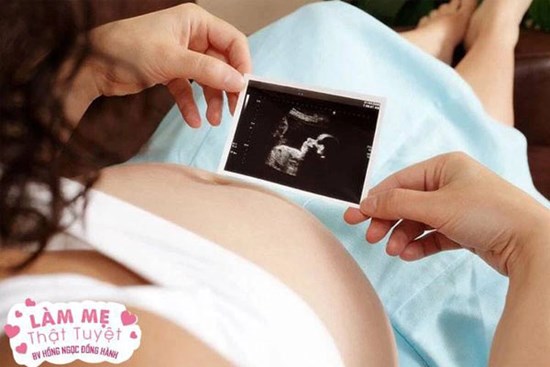 9 nguyên nhân tăng nguy cơ dị tật thai nhi mà các cặp vợ chồng đang chuẩn bị có con cần biết để tránh