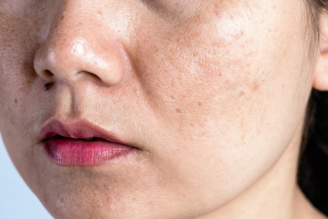 Phụ nữ sau tuổi 30 nên ăn 3 thực phẩm này vì siêu giàu estrogen, chị em vừa nâng ngực tự nhiên căng tròn vừa có làn da tràn đầy collagen-5