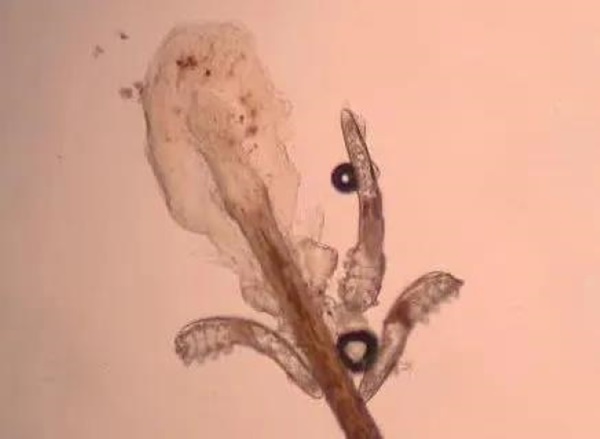 Người phụ nữ đột nhiên ngứa và tiết dịch trắng ở mắt, bác sĩ gắp ra rất nhiều sinh vật bò lồm ngồm chỉ vì sai lầm khi trang điểm nhiều chị em mắc phải-3