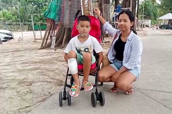 Bị cá mập tấn công, cậu bé sống sót nhờ nhanh trí làm 1 việc nhiều người lớn không biết-2