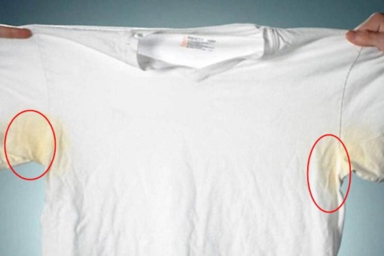 Mùa hè dùng lăn nách khiến áo ố vàng, cô gái được dân mạng bày cách “cứu cánh”: Chỉ 5 phút áo trắng tinh