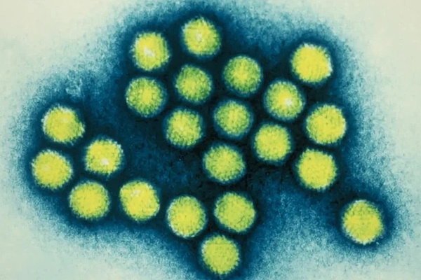 Trẻ bị bệnh viêm gan do virus bí ẩn thường có 2 dấu hiệu nhận biết, cha mẹ cần đưa con đi bệnh viện ngay-4