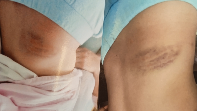 2 cháu nội bị cha dượng bạo hành trong thời gian dài, ông bà cầu cứu cơ quan chức năng-1