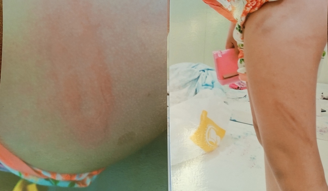 2 cháu nội bị cha dượng bạo hành trong thời gian dài, ông bà cầu cứu cơ quan chức năng-6