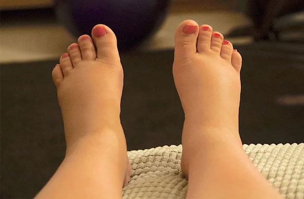 Người có thận yếu thường hội tụ 3 đặc điểm này trên cơ thể, mong rằng bạn không có bất kỳ điều nào-1