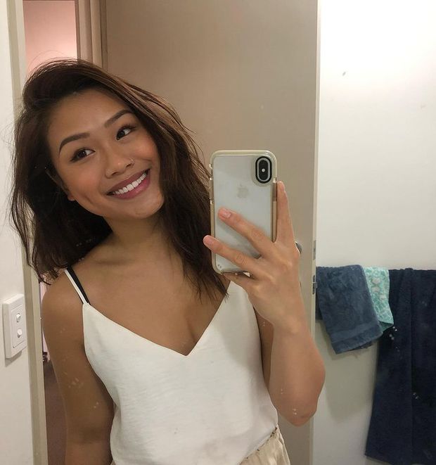 Bị bỏng nặng 75% gương mặt do nổ chảo dầu, 2 năm sau cô gái trẻ tự tin khoe diện mạo mới gây ngỡ ngàng-1