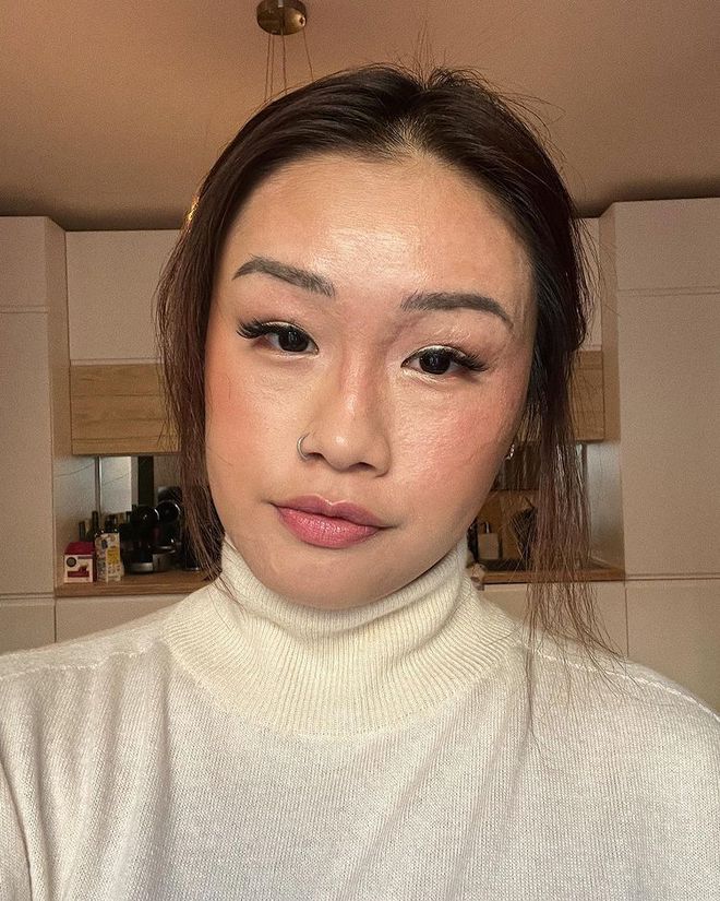 Bị bỏng nặng 75% gương mặt do nổ chảo dầu, 2 năm sau cô gái trẻ tự tin khoe diện mạo mới gây ngỡ ngàng-5