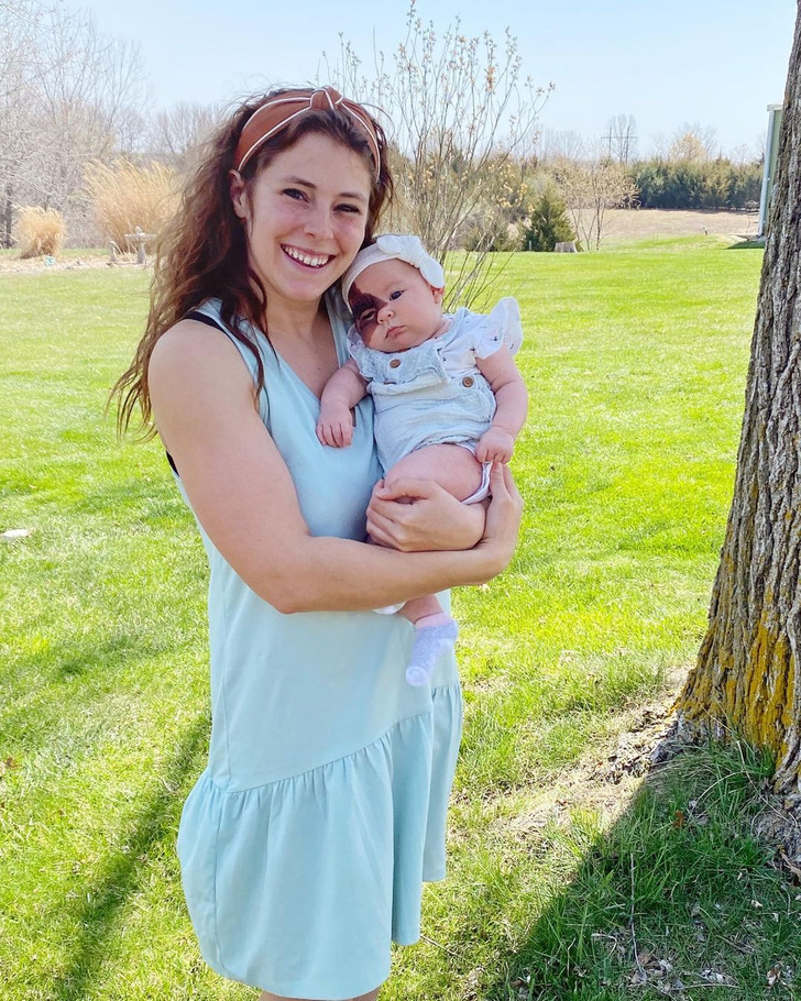 Cô bé sinh ra với vết bớt hiếm gặp trên mặt: Cách người mẹ dạy con tự tin, hay cười khiến ai cũng muốn học hỏi theo-6