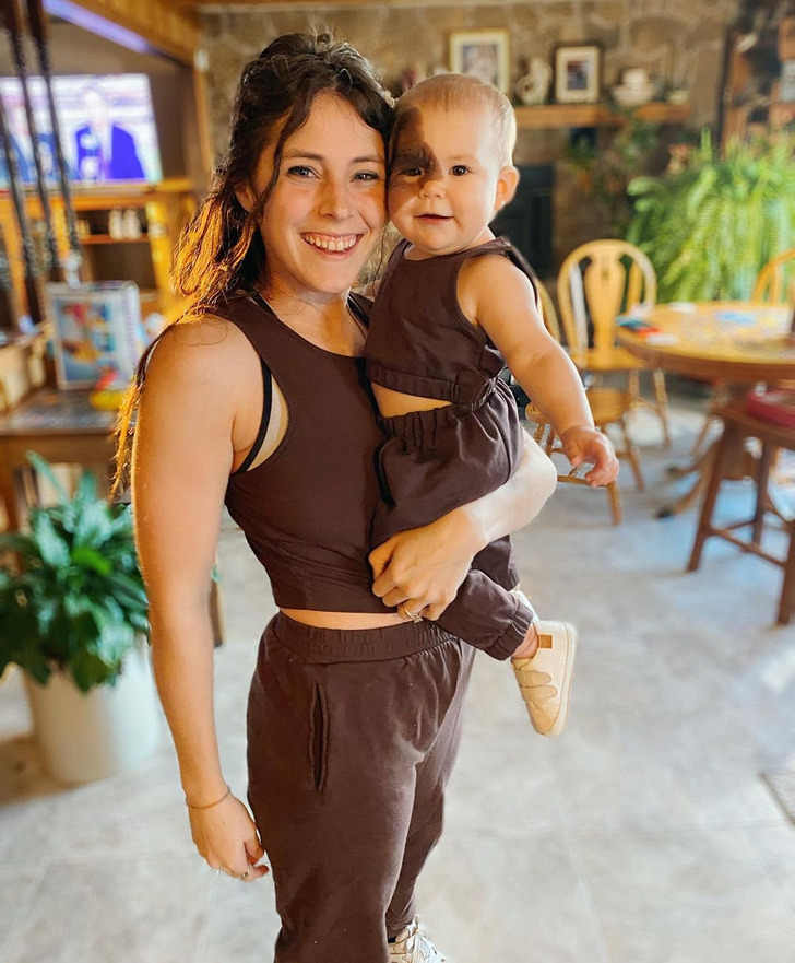 Cô bé sinh ra với vết bớt hiếm gặp trên mặt: Cách người mẹ dạy con tự tin, hay cười khiến ai cũng muốn học hỏi theo-7