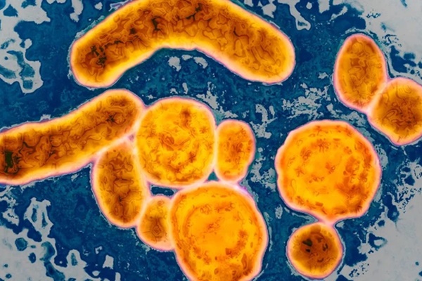 Thêm hai trẻ ở Indonesia tử vong vì viêm gan bí ẩn-1