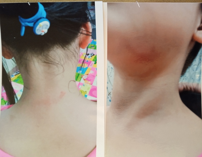 Vụ 2 bé gái nghi bị cha dượng bạo hành ở Hà Nội: Ông ngoại rơi nước mắt khi nhắc tới con gái, mong 2 cháu được ông bà nội chăm sóc-3