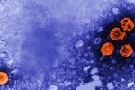 5 giả thuyết về nguyên nhân gây bệnh viêm gan bí ẩn-4