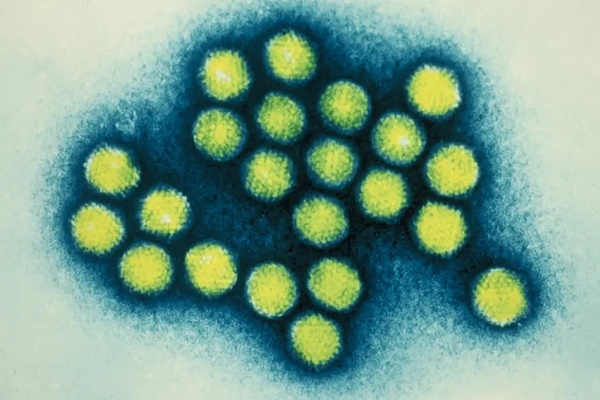 10% trẻ mắc viêm gan cấp tính phải ghép gan, Bộ Y tế hướng dẫn cách phòng tránh-1