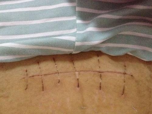 Nếu được làm lại tất cả, tôi sẽ chọn cách sinh tự nhiên, bà mẹ trẻ đăng đàn bầu bạn đêm khuya, khóc lóc kể về nỗi cay đắng khi sinh mổ-3