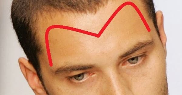 Nhận diện tướng trán của người đàn ông thông minh, thành đạt, giàu sang hơn người-2