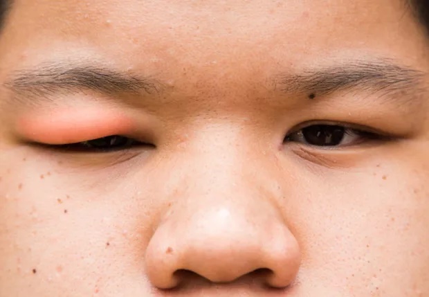 Soi gương buổi sáng: nếu có 4 triệu chứng bất thường thì nên đi khám càng sớm càng tốt-1