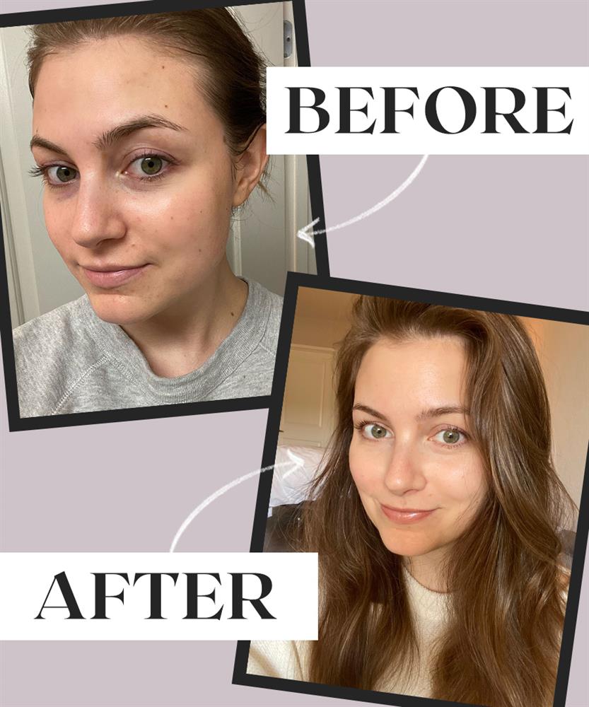 Cô nàng trẻ hẳn ra nhờ tự trị quầng thâm mắt tại nhà, có cách không tốn một xu-1