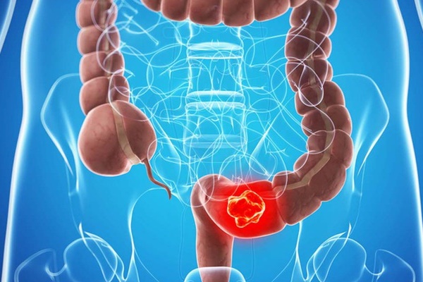 5 thức uống trong danh sách hại sức khỏe, loại thứ 2 còn có thể gây ung thư-5