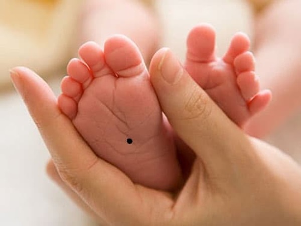 Nốt ruồi ở vị trí này, trẻ sớm mang mệnh quý nhân, mang lại tài lộc và giàu sang-1