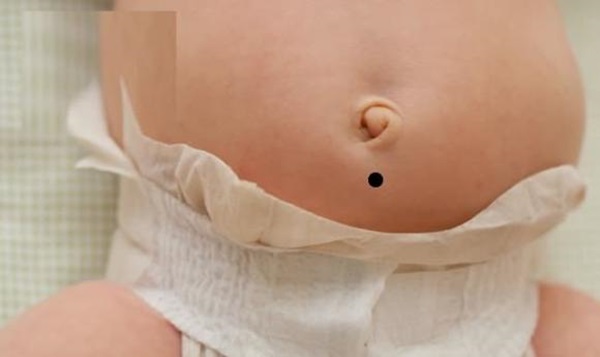 Nốt ruồi ở vị trí này, trẻ sớm mang mệnh quý nhân, mang lại tài lộc và giàu sang-3