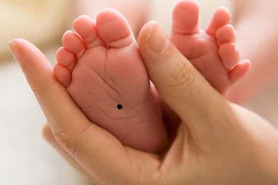 Nốt ruồi ở vị trí này, trẻ sớm mang mệnh quý nhân, mang lại tài lộc và giàu sang