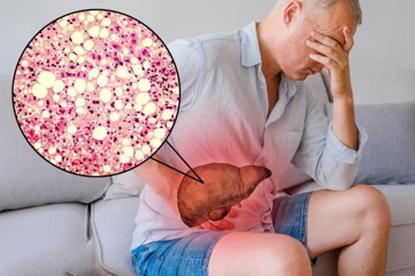 Những thói quen giết gan nhanh khủng khiếp, nhiều người Việt làm hằng ngày-1