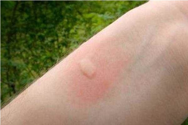 Có hành tây ở nhà mà không biết đến mẹo này thì phí: 3 công dụng đầu tiên rất cần thiết và không thể bỏ qua-2