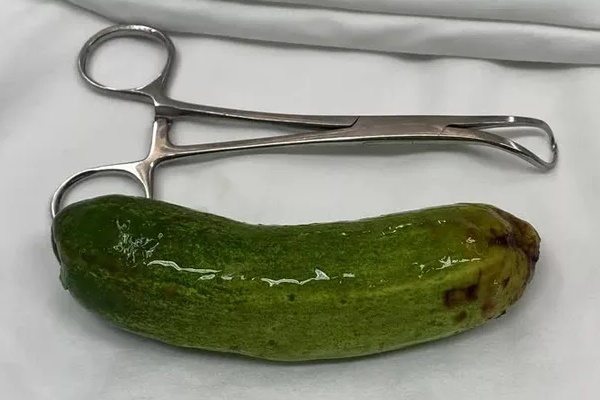 Thử cảm giác lạ, thanh niên nhét quả dưa leo dài hơn 10cm vào hậu môn-1