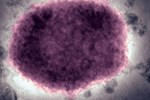 Virus gây bệnh hiếm gặp đã lan sang Mỹ-1