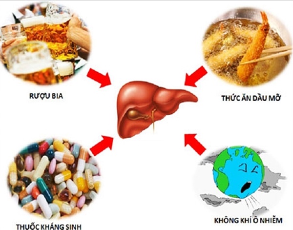 5 sát thủ khiến gan tổn thương và lời khuyên của thầy thuốc-3