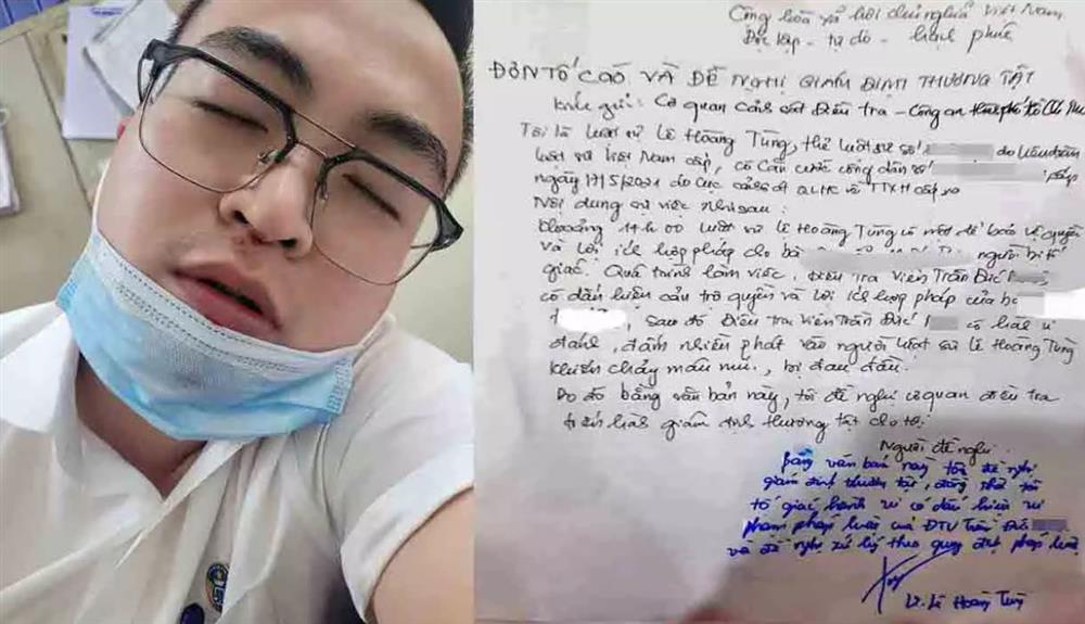 Vụ luật sư ‘tố’ điều tra viên hành hung, công an nói… trượt ngã-1