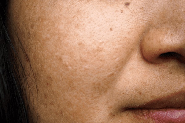 Xuất hiện cơn co giật toàn thân, cô gái đi khám, phát hiện ung thư phổi-2